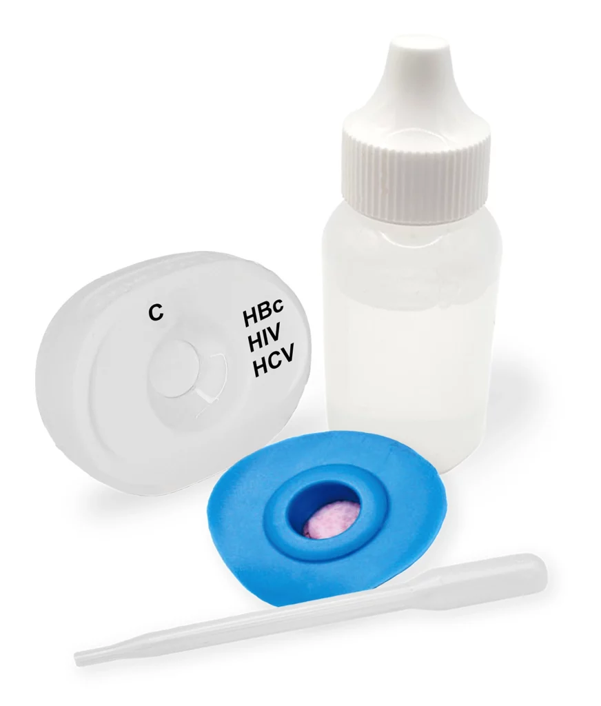 HBC HIV HCV LAB S.P