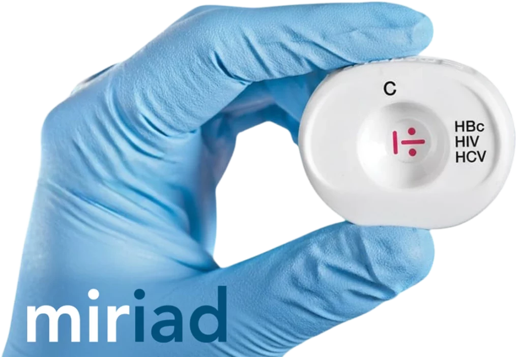 HBc HIV HCV blue glove miriad