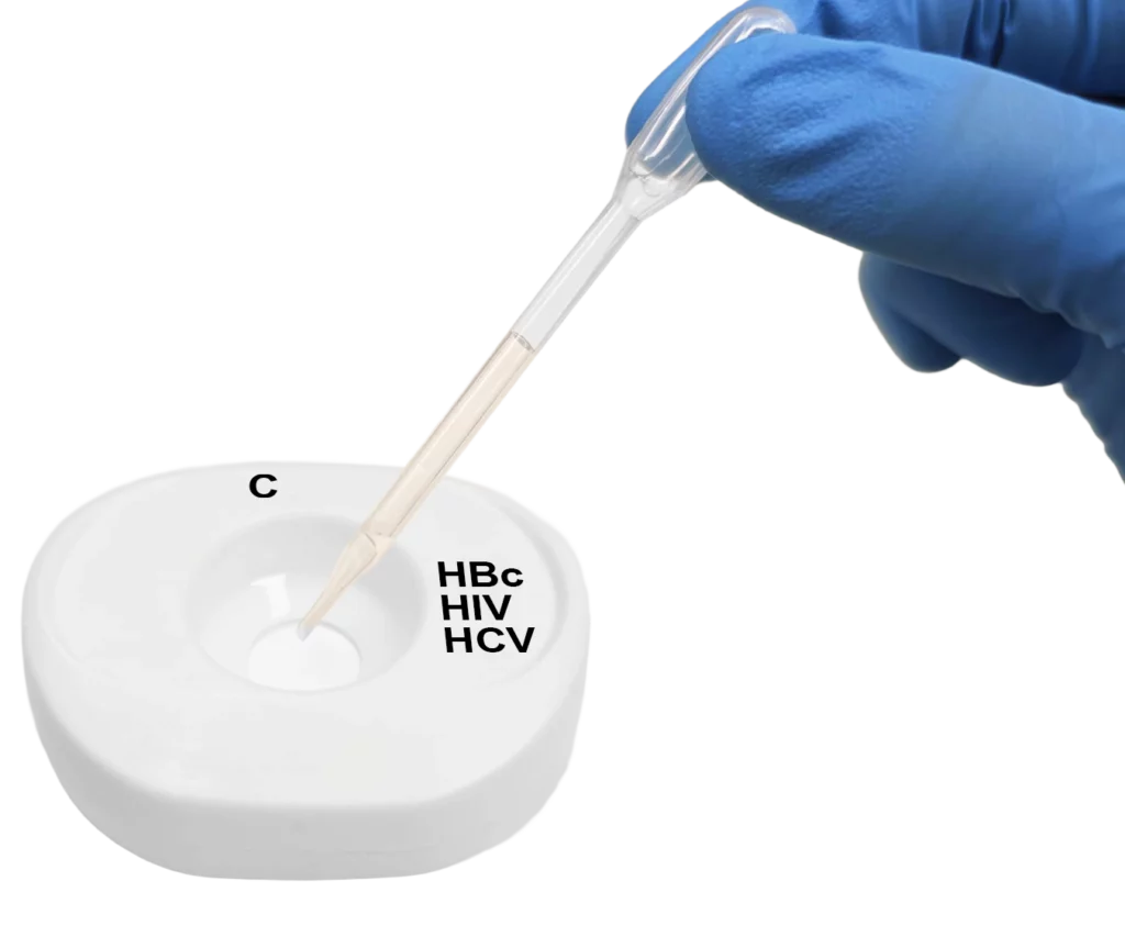 HBc HIV HCV PlasmaSerum step2