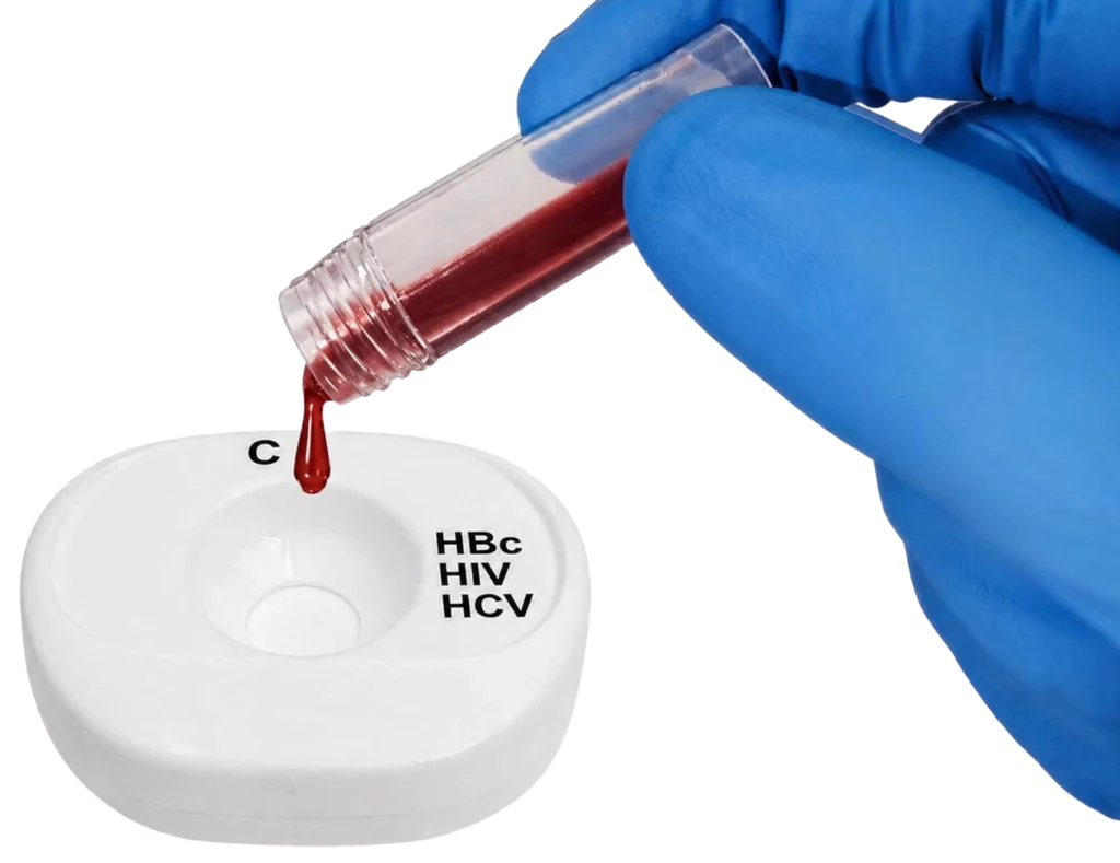 HBc HIV HCV blood step1