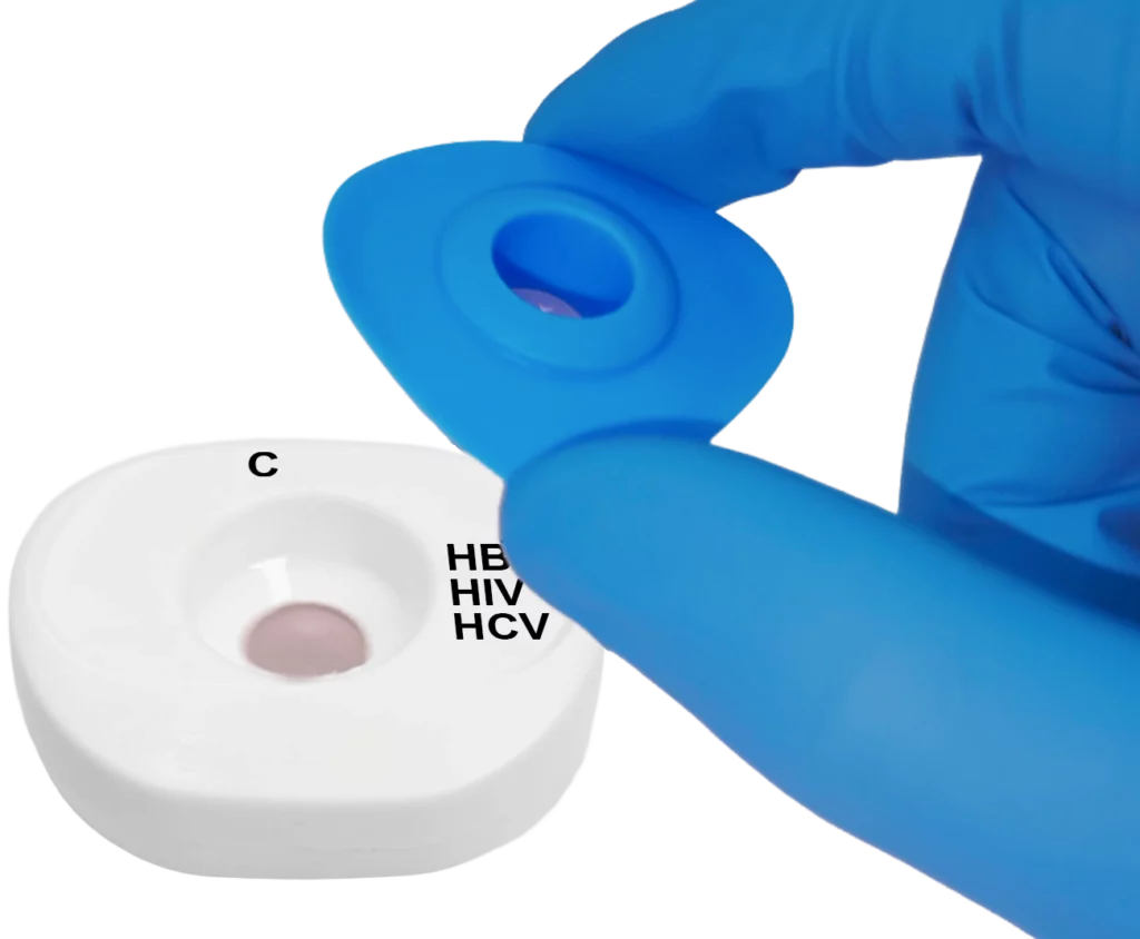 HBc HIV HCV blood step2