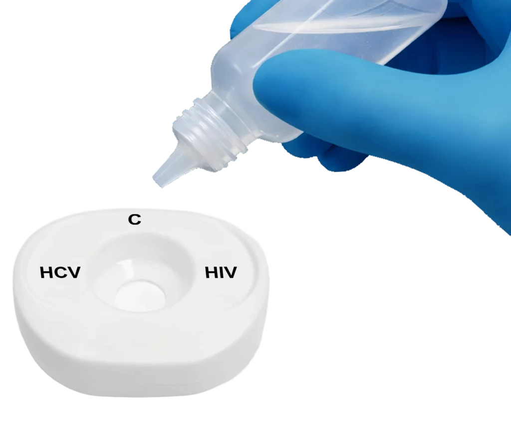 HCV HIV SerumPlasma Step1