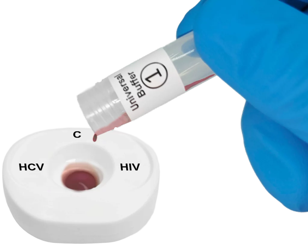 HCV HIV blood step1