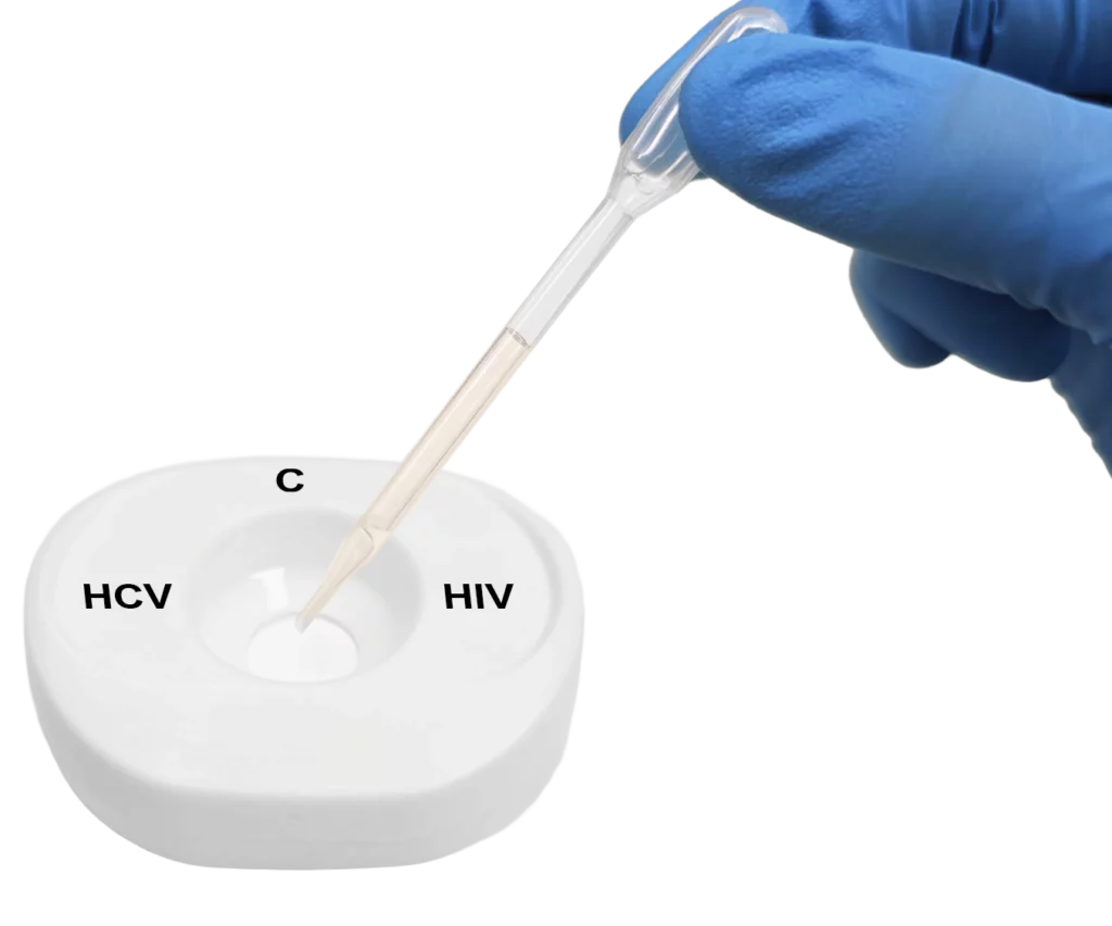 HIV HCV PlasmaSerum step2