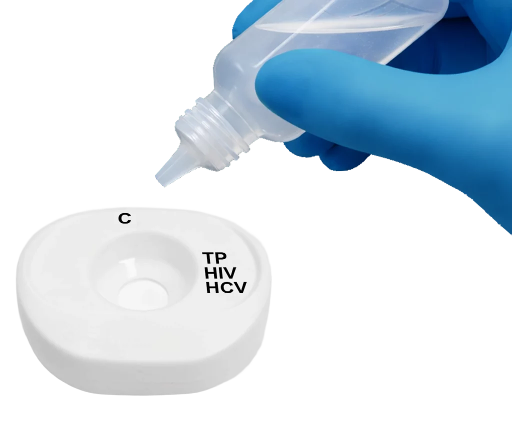 TP HIV HCV PlasmaSerum step1