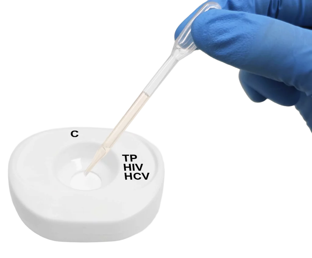 TP HIV HCV PlasmaSerum step2