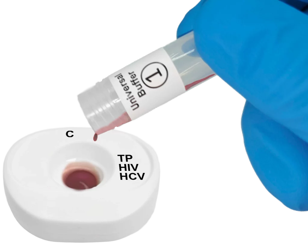 TP HIV HCV blood step1