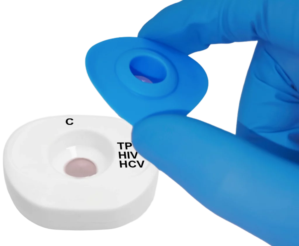 TP HIV HCV blood step2