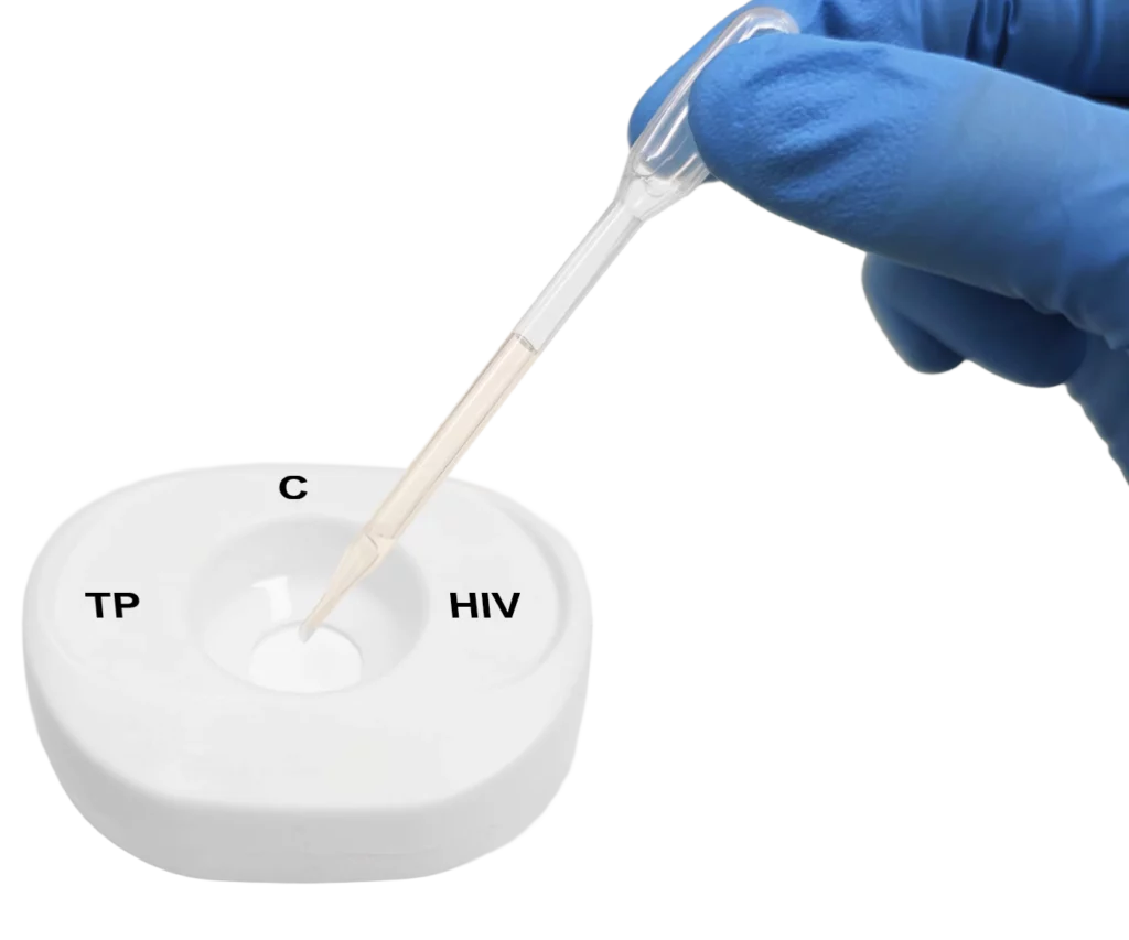 TP HIV PlasmaSerum Step2