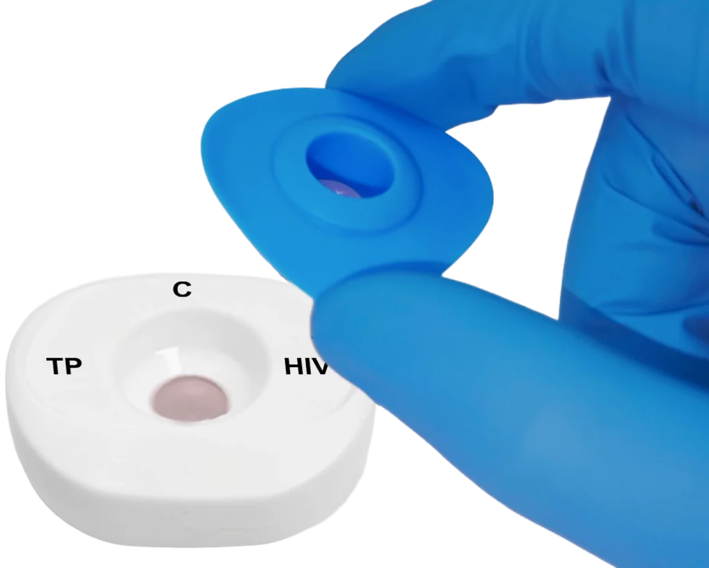 TP HIV blood step2