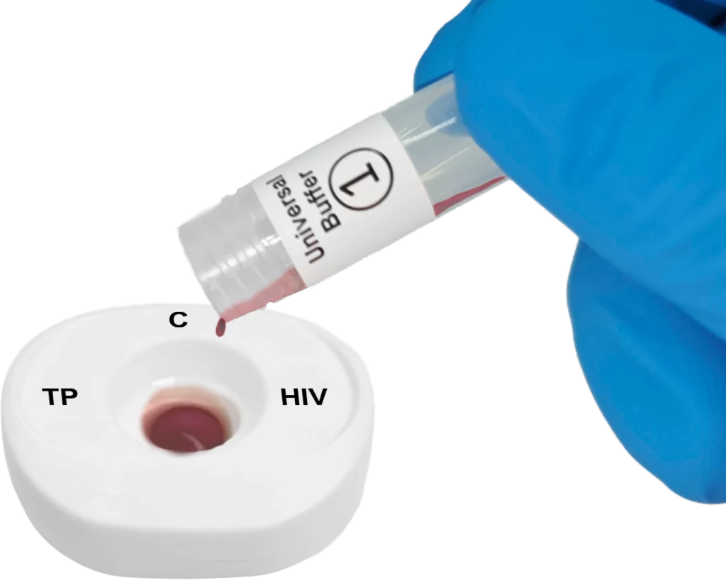 TP HIV blood stept1