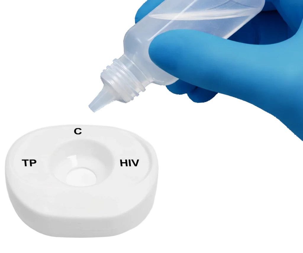 TP HIV PlasmaSerum Step1