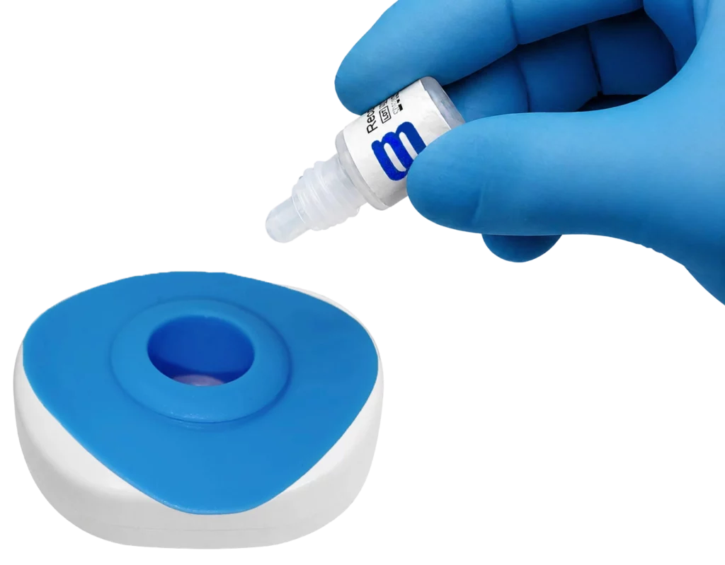 HBc HIV HCV blood step1